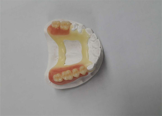 Natural Look Rubber PFM Dental Crown 3D Printer Dental Laboratory